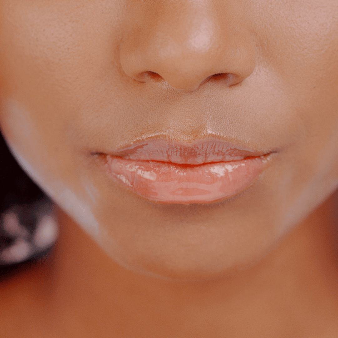 Plump lips from lip filler