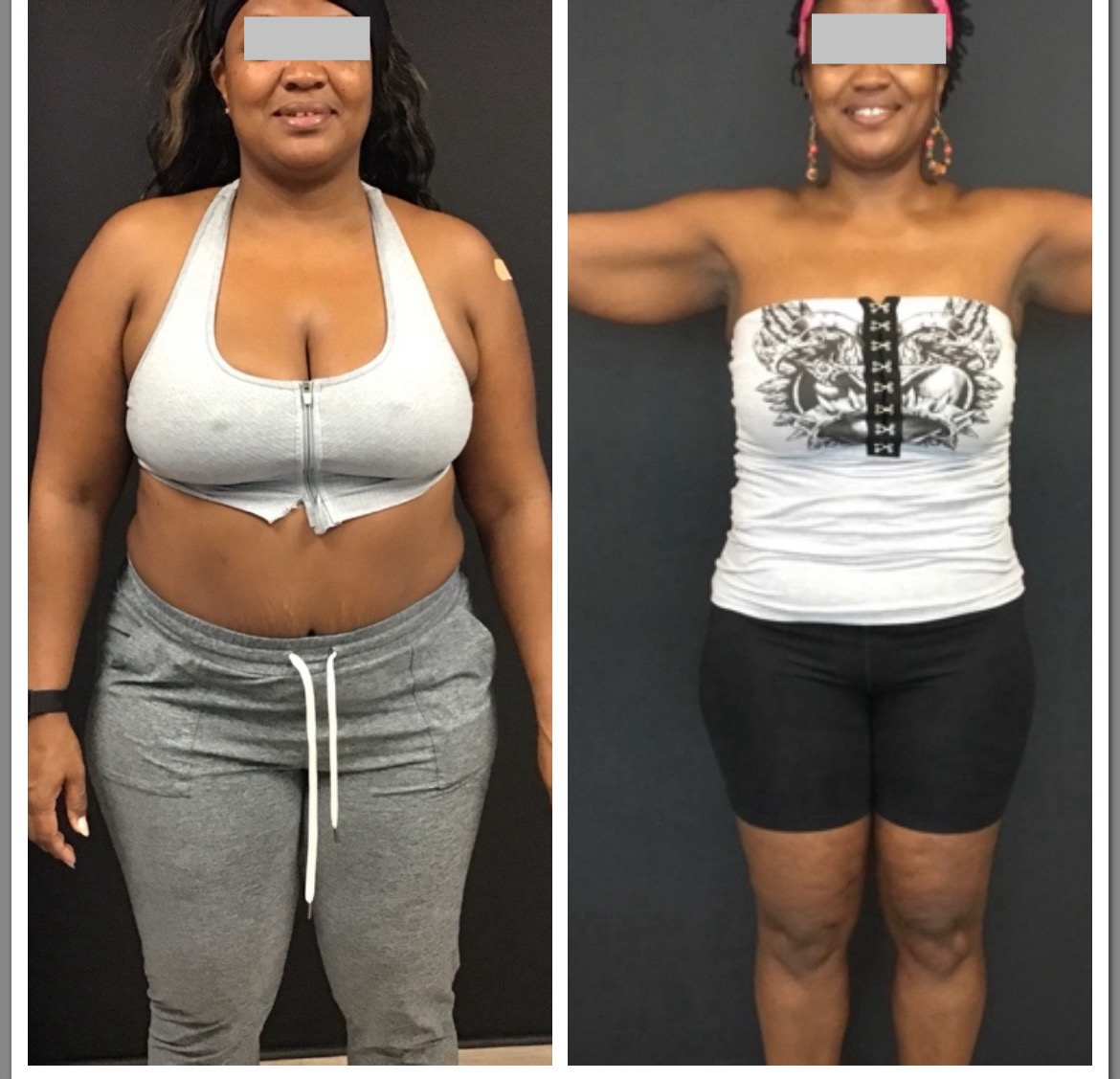 Before and After Image: Medical Weight Loss - front
