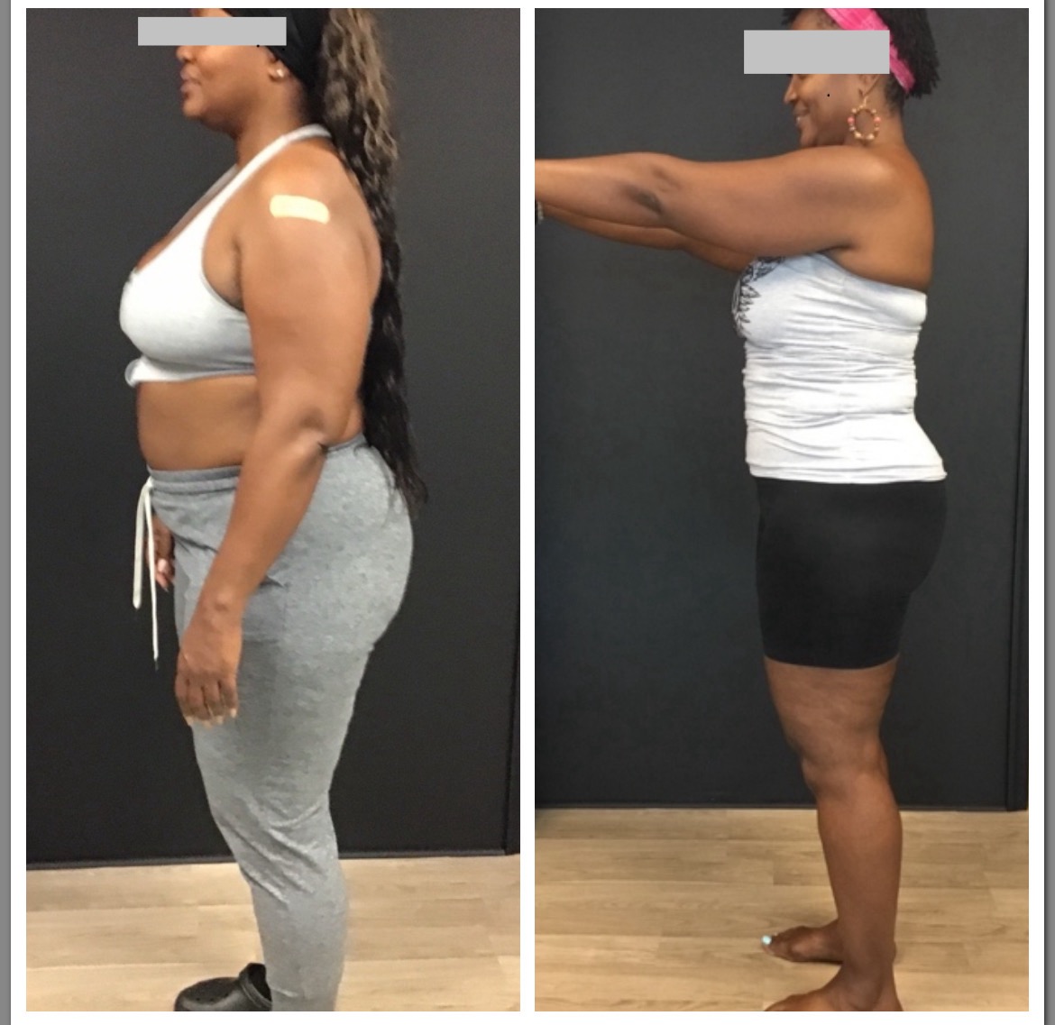 Before and After Image: Medical Weight Loss - left-side