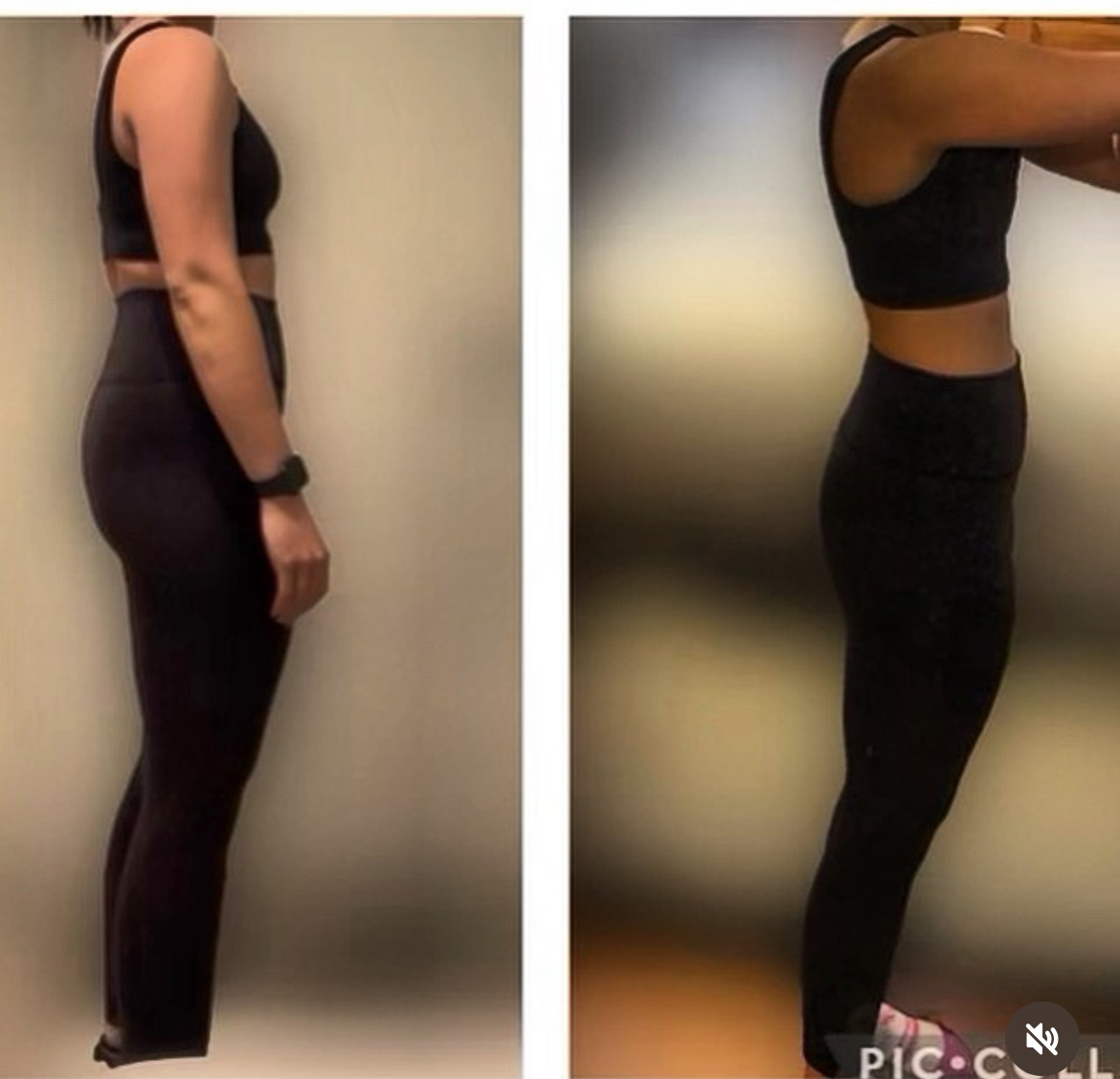 Before and After Image: Semaglutide Weight Loss - front