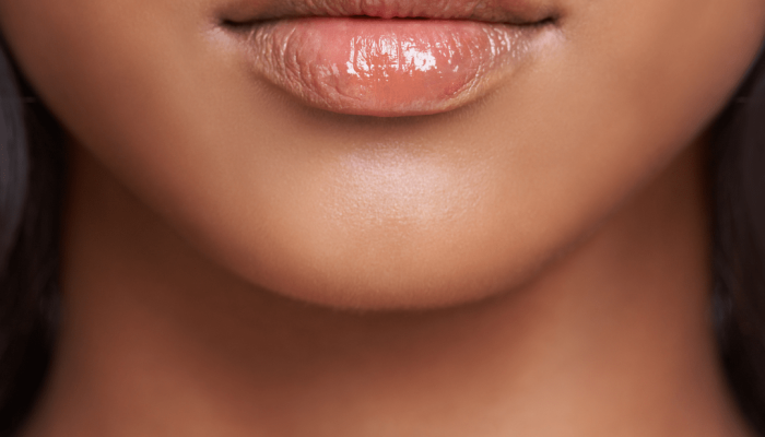 lip filler, plump lips